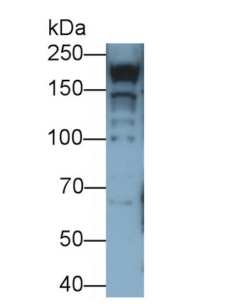 Monoclonal Antibody to Myosin Heavy Chain 7, Cardiac Muscle, Beta (MYH7)