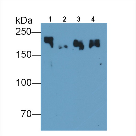 Monoclonal Antibody to Myosin Heavy Chain 8, Skeletal Muscle, Perinatal (MYH8)