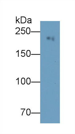 Monoclonal Antibody to Myosin Heavy Chain 8, Skeletal Muscle, Perinatal (MYH8)