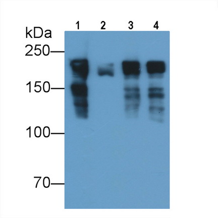 Monoclonal Antibody to Myosin Heavy Chain 8, Skeletal Muscle, Perinatal (MYH8)