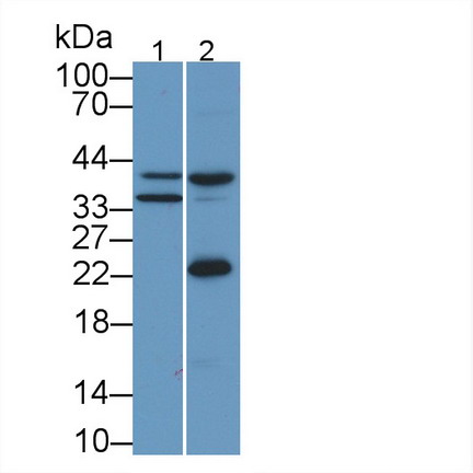 Monoclonal Antibody to Apolipoprotein L2 (APOL2)