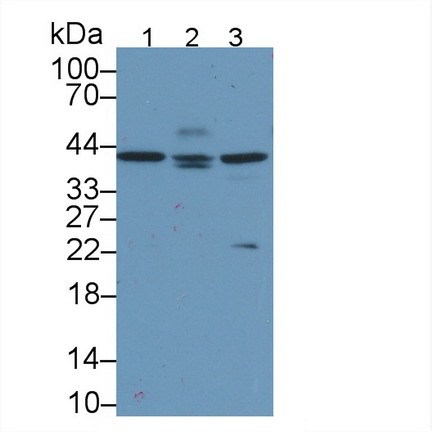 Monoclonal Antibody to Apolipoprotein L2 (APOL2)