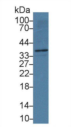 Monoclonal Antibody to Apolipoprotein L2 (APOL2)