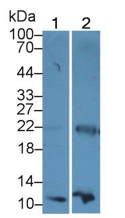 Monoclonal Antibody to Diazepam Binding Inhibitor (DBI)