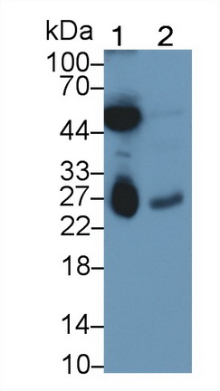 Monoclonal Antibody to Deoxythymidylate Kinase (DTYMK)