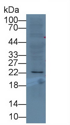 Monoclonal Antibody to Deoxythymidylate Kinase (DTYMK)