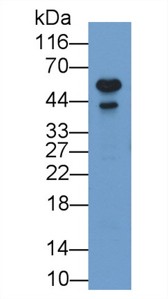 Monoclonal Antibody to Arginase II (Arg2)