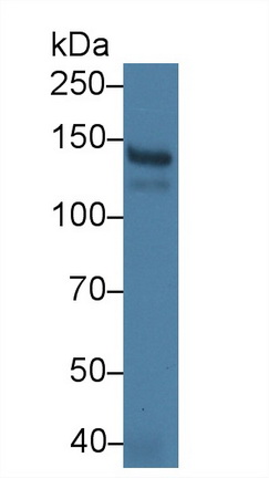 Monoclonal Antibody to Phospholipase A2 Receptor 1 (PLA2R1)