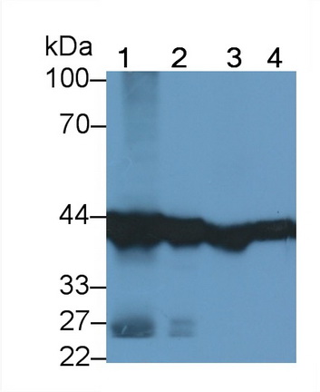 Monoclonal Antibody to Aspartate Aminotransferase 2 (AST2)