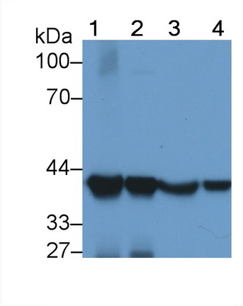 Monoclonal Antibody to Aspartate Aminotransferase 2 (AST2)