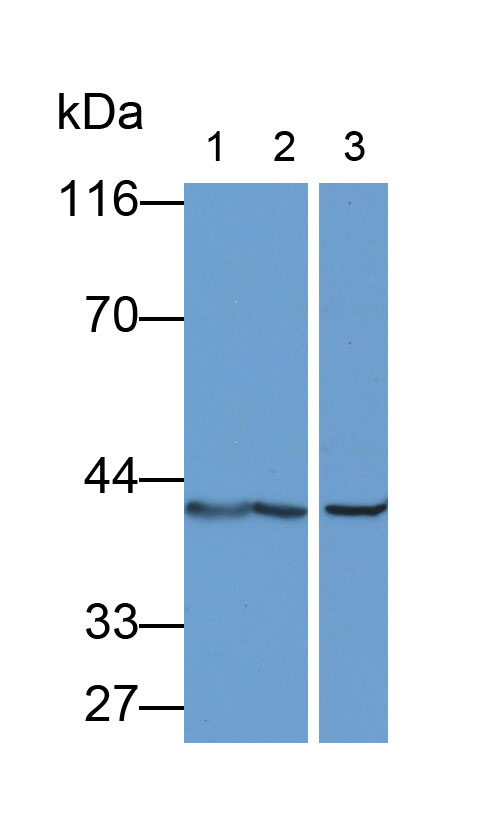 Monoclonal Antibody to Aspartate Aminotransferase 2 (AST2)