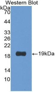 Monoclonal Antibody to Procollagen C Proteinase Enhancer 2 (PCPE2)