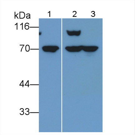 Monoclonal Antibody to Neurofilament, Light Polypeptide (NEFL)