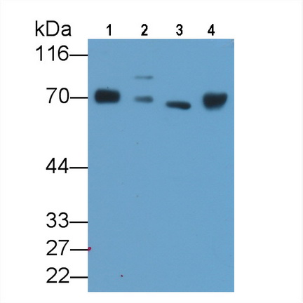 Monoclonal Antibody to Neurofilament, Light Polypeptide (NEFL)