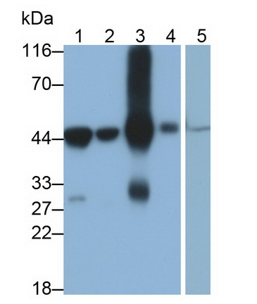 Monoclonal Antibody to 4-Hydroxyphenylpyruvate Dioxygenase (HPD)