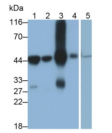 Monoclonal Antibody to 4-Hydroxyphenylpyruvate Dioxygenase (HPD)