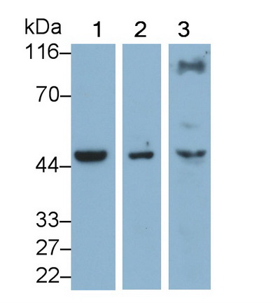 Monoclonal Antibody to 4-Hydroxyphenylpyruvate Dioxygenase (HPD)