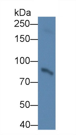 Monoclonal Antibody to Procollagen Lysine-2-Oxoglutarate-5-Dioxygenase 2 (PLOD2)