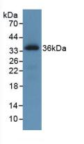 Monoclonal Antibody to C-Ros Oncogene 1, Receptor Tyrosine Kinase (ROS1)