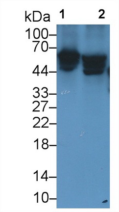 Monoclonal Antibody to Folate Transporter (FOLT)