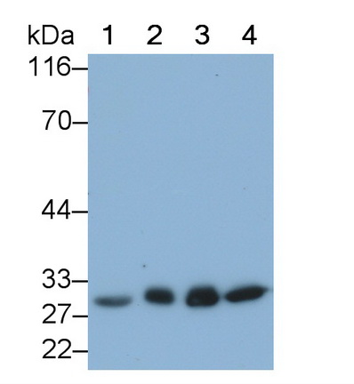 Monoclonal Antibody to Phosphoglycerate Mutase 1, Brain (PGAM1)