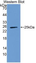 Monoclonal Antibody to Alpha-1-B-Glycoprotein (a1BG)