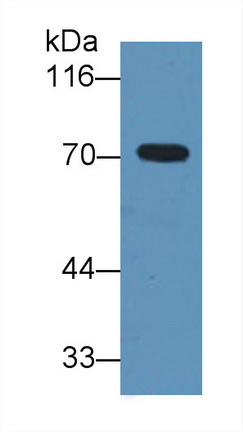 Monoclonal Antibody to Alpha-1-B-Glycoprotein (a1BG)