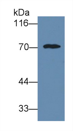 Monoclonal Antibody to Alpha-1-B-Glycoprotein (a1BG)