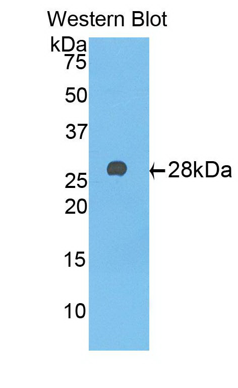 Monoclonal Antibody to Alpha-1-B-Glycoprotein (a1BG)