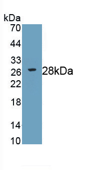 Monoclonal Antibody to Receptor Interacting Serine Threonine Kinase 3 (RIPK3)