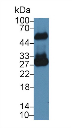 Monoclonal Antibody to FK506 Binding Protein 7 (FKBP7)