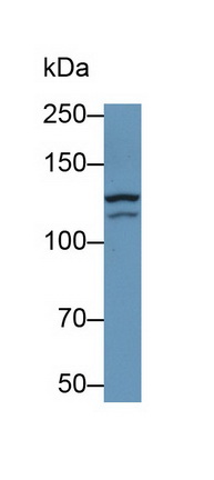 Monoclonal Antibody to Glutamate Receptor, Ionotropic, N-Methyl-D-Aspartate 2D (GRIN2D)