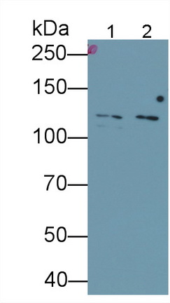 Monoclonal Antibody to Glutamate Receptor, Ionotropic, N-Methyl-D-Aspartate 2D (GRIN2D)