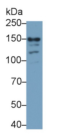 Monoclonal Antibody to Glutamate Receptor, Ionotropic, N-Methyl-D-Aspartate 2D (GRIN2D)