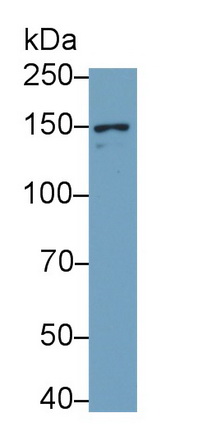 Monoclonal Antibody to Glutamate Receptor, Ionotropic, N-Methyl-D-Aspartate 2D (GRIN2D)