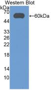 Monoclonal Antibody to Aldehyde Dehydrogenase 7 Family, Member A1 (ALDH7A1)