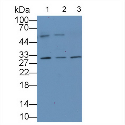 Monoclonal Antibody to Interleukin 1 Epsilon (IL1e)