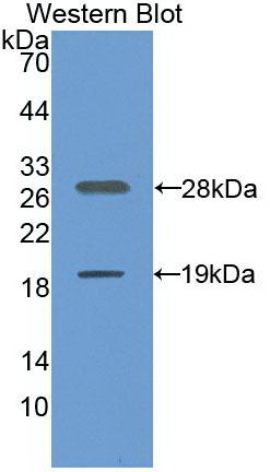 Monoclonal Antibody to Sirtuin 1 (SIRT1)