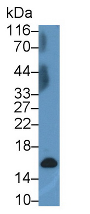 Monoclonal Antibody to Cellular Retinoic Acid Binding Protein 2 (CRABP2)