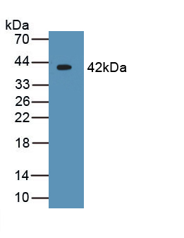 Monoclonal Antibody to Crystallin Lambda 1 (CRYl1)