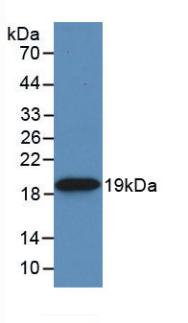 Monoclonal Antibody to Heat Shock Protein Beta 6 (HSPb6)