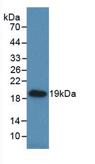 Monoclonal Antibody to Heat Shock Protein Beta 6 (HSPb6)