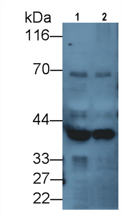 Monoclonal Antibody to Doublecortin Like Kinase 1 (DCLK1)