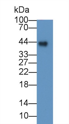 Monoclonal Antibody to Folate Receptor 1, Adult (FOLR1)