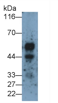 Monoclonal Antibody to Kisspeptin Receptor (KISS1R)