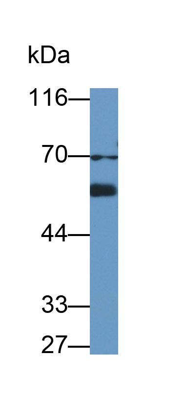 Monoclonal Antibody to Lamin B1 (LMNB1)