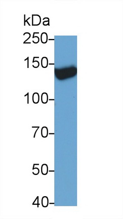 Monoclonal Antibody to Transient Receptor Potential Cation Channel Subfamily M, Member 4 (TRPM4)