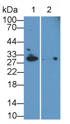 Monoclonal Antibody to Microtubule Associated Protein RP/EB Family, Member 1 (MAPRE1)