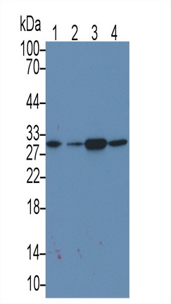 Monoclonal Antibody to Microtubule Associated Protein RP/EB Family, Member 1 (MAPRE1)