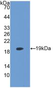 Monoclonal Antibody to Lysophosphatidylcholine Acyltransferase 3 (LPCAT3)